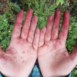 Hände nach Blaubeerernte
